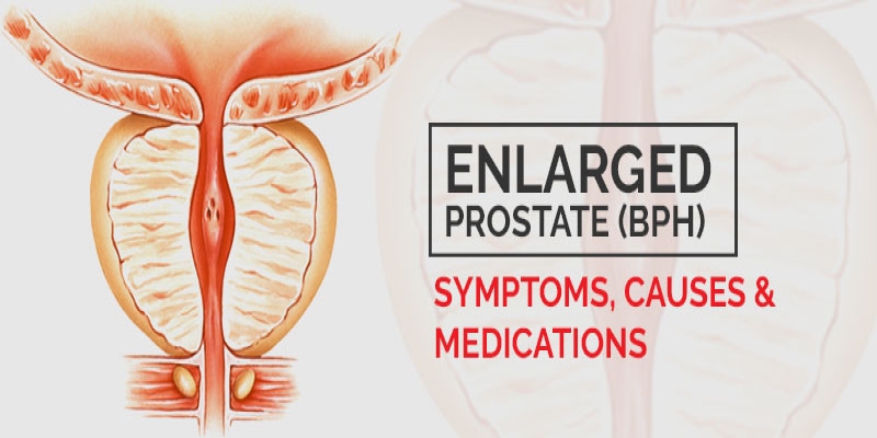 Enlarged-Prostate medication & treatment