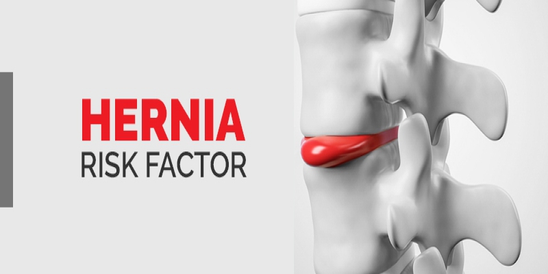 Risk Factors for Hernia