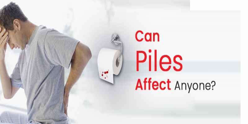 Symptoms You may not Expect with Piles