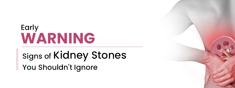 Early Warning Signs of Kidney Stones