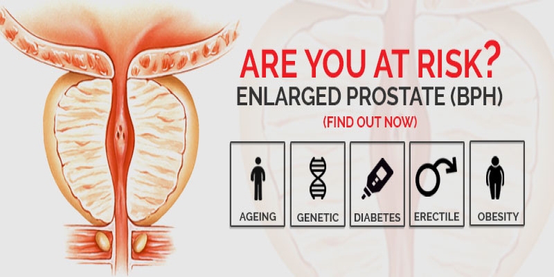 What are The Risk Factors for BPH / Enlarged-Prostate?