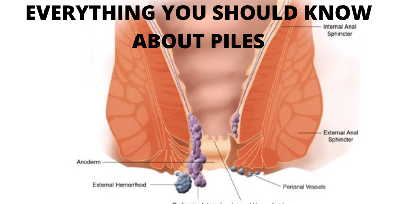 EVERYTHING YOU SHOULD KNOW ABOUT PILES