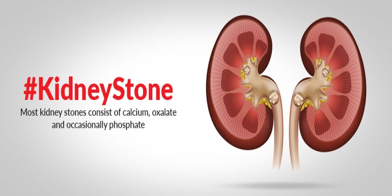 Save Yourself from Kidney Stones