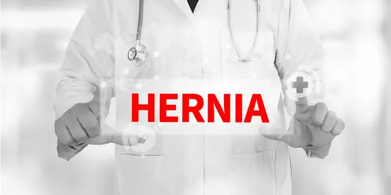 Hernia Types and Hernia Prevention