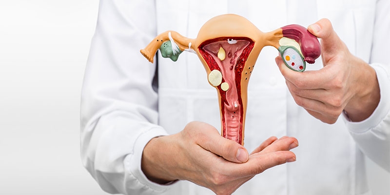 What is Ovarian Cancer? Symptoms, Causes, Risk Factors, Signs, Stages, Diagnosis