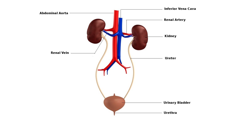 Urinary / Kidney Stone