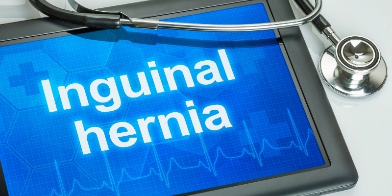 Types of Inguina hernia repair